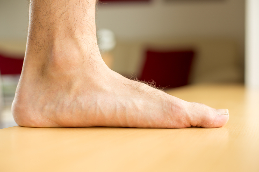 Flat Feet in Yorville and Morris, IL